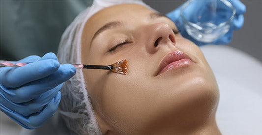 Light Chemical Peel